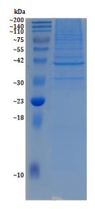mitochondrial-protein-extraction-kit