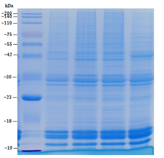 histone-protein-extraction-kit